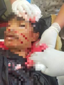 Dendam Kesumat, Pemuda di Lombok Tengah Nekat Gorok Leher Tetangganya