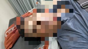 Diduga Mengantuk, Sopir Pick Up Tabrak Sepeda Motor, Satu Orang Meninggal Dunia