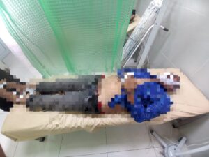 Seorang Warga Meninggal Dunia Diduga Tergulung Ombak di Wisata Pantai Senek