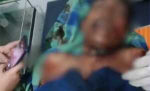 Dicurigai Dukun Santet, Satu Keluarga di Bima Dibacok Hingga Tewas