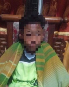 Gerak Cepat Polsek Bolo Evakuasi Terduga Pelaku Pencurian yang Dihajar Massa