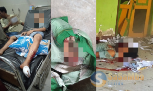 Ternyata! Petasan 8 Kg Penyebab Imran Terkapar, Dua Jarinya Putus