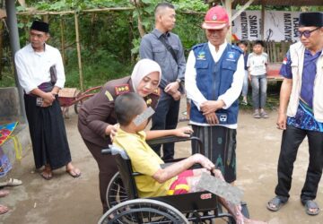 Kejari – Dinsos Lombok Tengah Salurkan Bantuan untuk Santri Korban Luka Bakar, Tegaskan Komitmen Perlindungan Anak