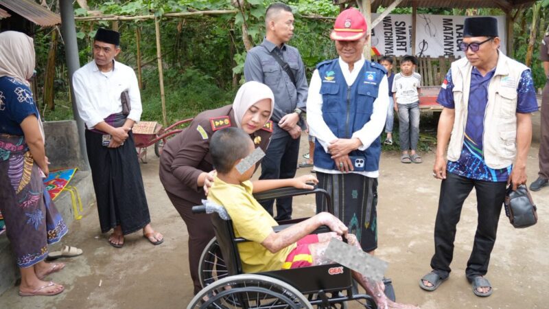 Kejari – Dinsos Lombok Tengah Salurkan Bantuan untuk Santri Korban Luka Bakar, Tegaskan Komitmen Perlindungan Anak