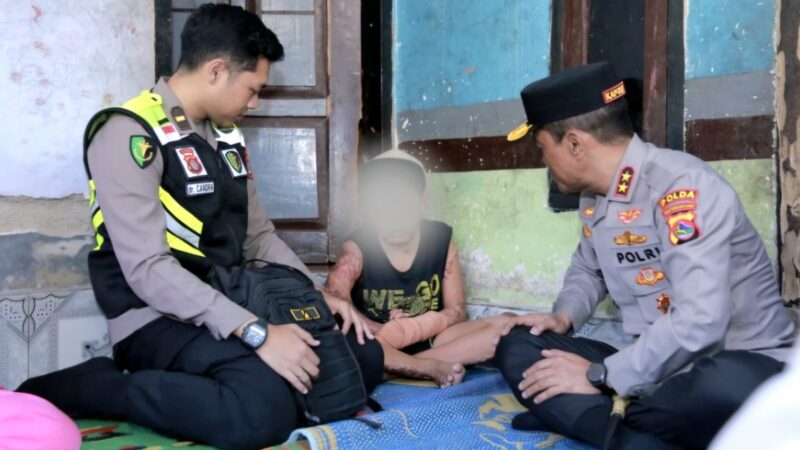 Usai Temui Santri Korban Dugaan Kekerasan, Kapolda NTB Pastikan Penanganan Kasus Berjalan Cepat